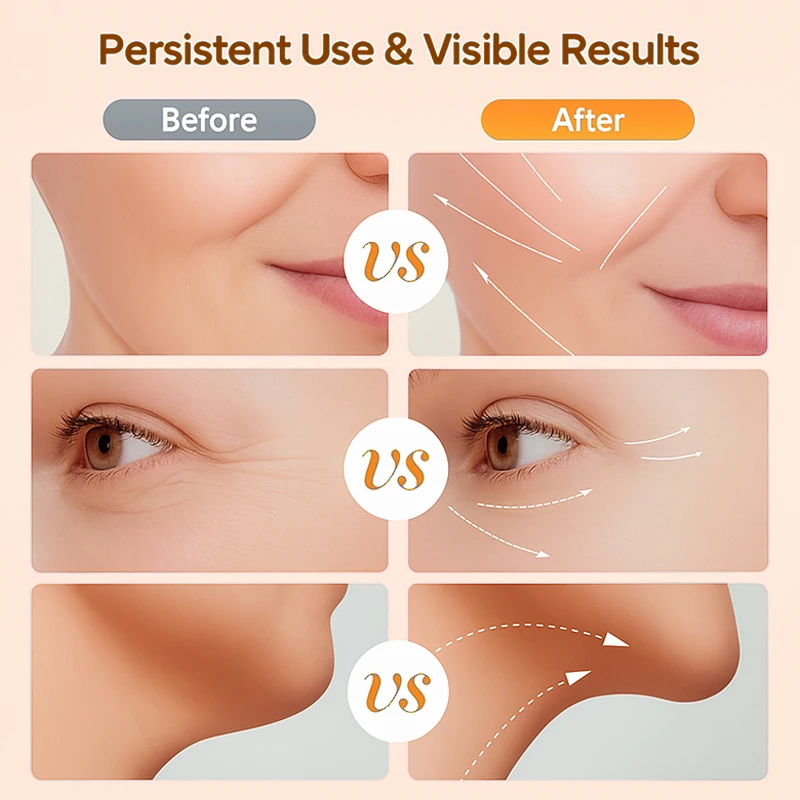 ネック美容リフティングマシン EMS光線療法 フェイシャルマッサージャー 引き締め 二重あご対策 しわ取り ネックリフティング美容器