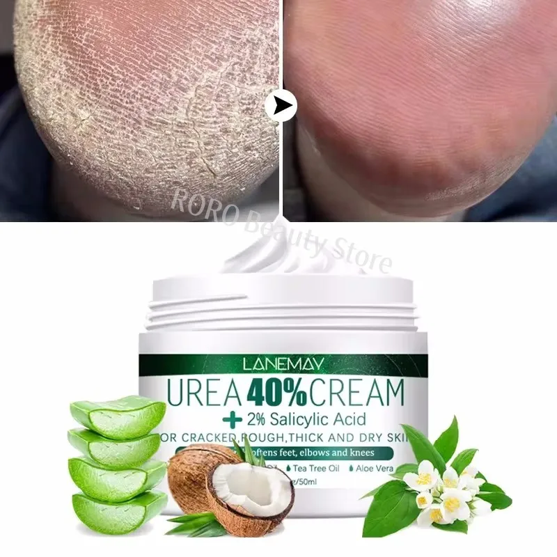 Anti Drying Feet Cream Heel Cracking Repair Products Exfoliation Dead Skin Beriberi Removal Soften Moisturizing Hand Feet Care