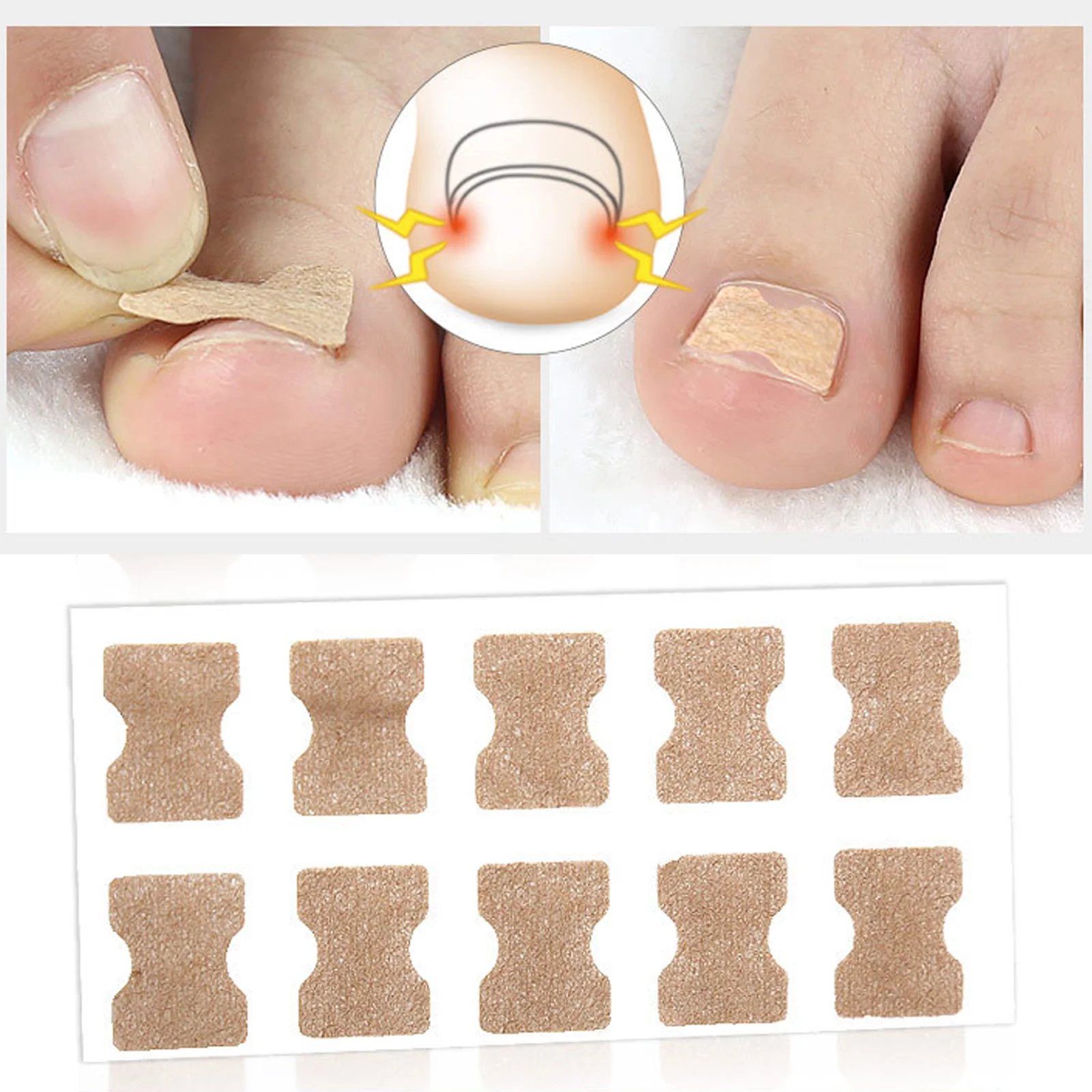 

10 Pcs Ingrown Toenail Corrector Sticker Foot Care Paronychia Treatment Pedicure Foot Orthodontic Toe Thumb Nail Care Patches