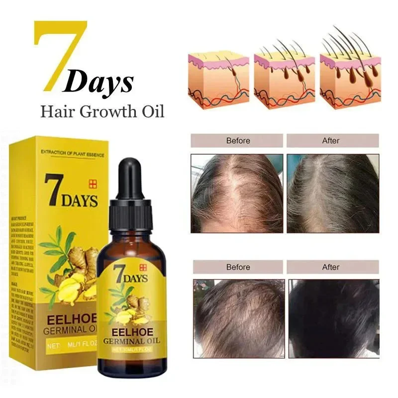 7 Days Fast Ginger Hair Growth Serum Anti-Loss Hair Regrowth Treatment Essential Oil Repair Damaged Hair Roots Hair Care Product