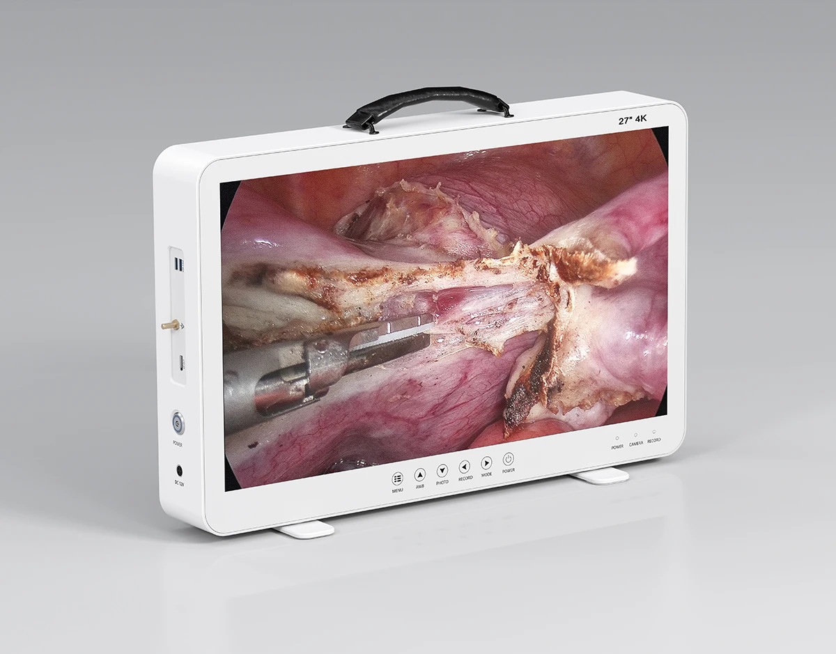 

4K Ultra 27 Inch Monitor Laparoscopic Camera UHD Medical Endoscope System with HDMI Input