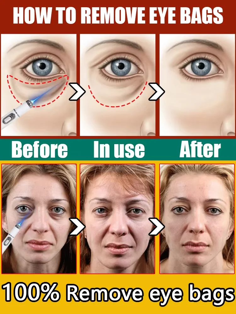 ตัวชี้เลเซอร์ช่วยแก้ปัญหาสายตาได้ทั้งหมด