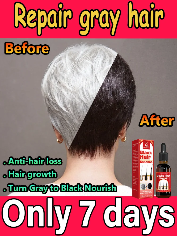 

White to Black Hair Serum Gʀᴀʏ Hᴀɪʀ Tʀᴇᴀᴛᴍᴇɴᴛ Nᴀᴛᴜʀᴀʟ Cᴏʟᴏʀ Rᴇᴘᴀɪʀ Nᴏᴜʀɪsʜɪɴɢ Aɴᴛɪ-Hᴀɪʀ Lᴏss Cᴀʀᴇ Mᴇɴ Wᴏᴍᴇɴ