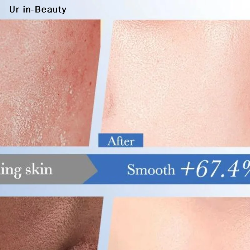 Crema hidratante BIOAOUA con ceramida y ácido hialurónico 400g, blanqueadora e hidratante para mejorar los problemas de la piel