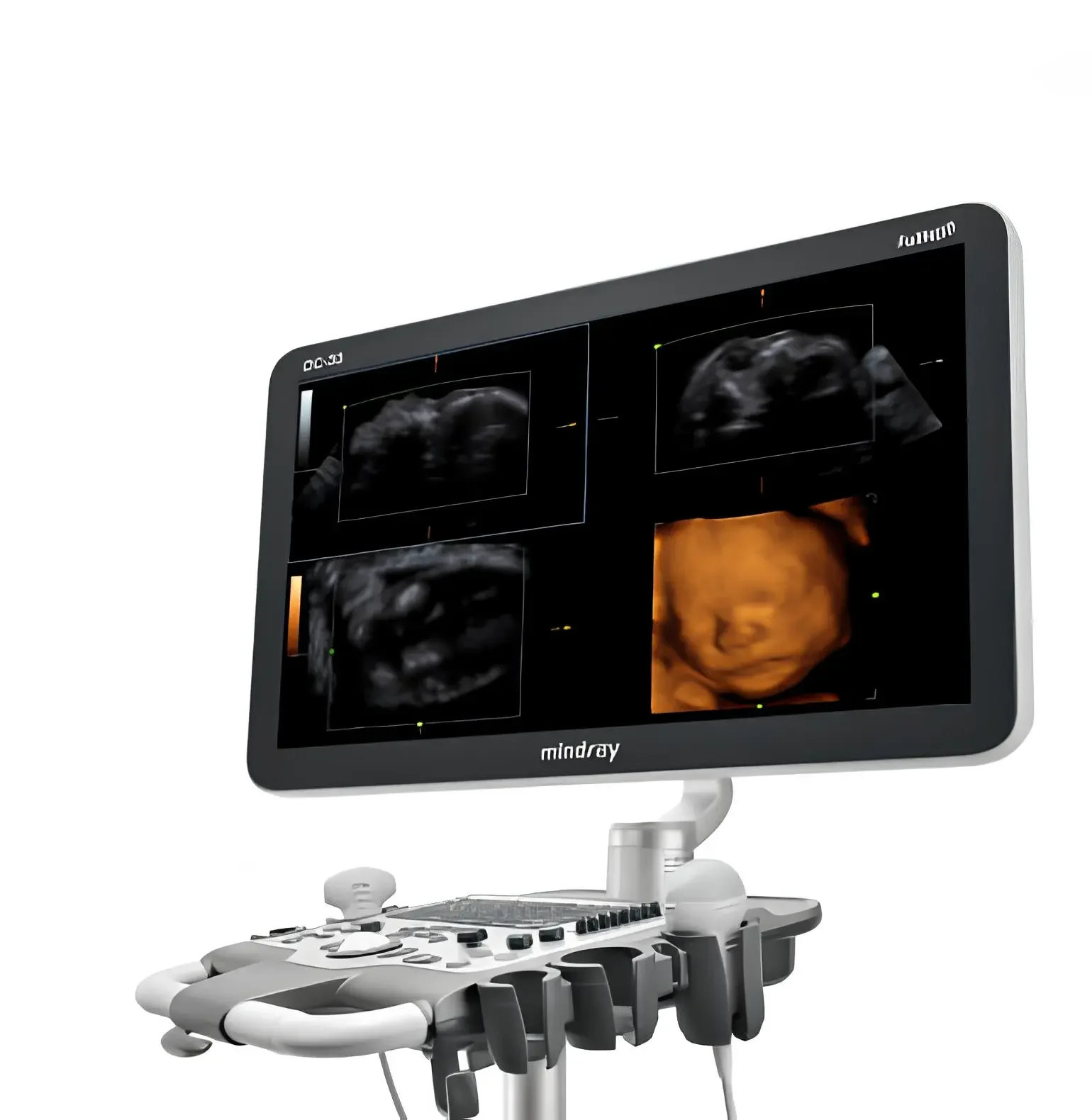 DC30 Doppler Color Ultrasound Primary Care Diagnostic Ultrasound 21.5 inch full high definition image 3D 4D Imaging Econ