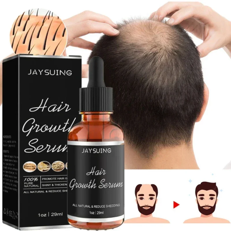 2024 Biotin Fast Hair Growth Oil aHair Regrowth Serum aHair Thinning Treatment aHair Growth Liquid Anti-Hair Loss for Women&Men