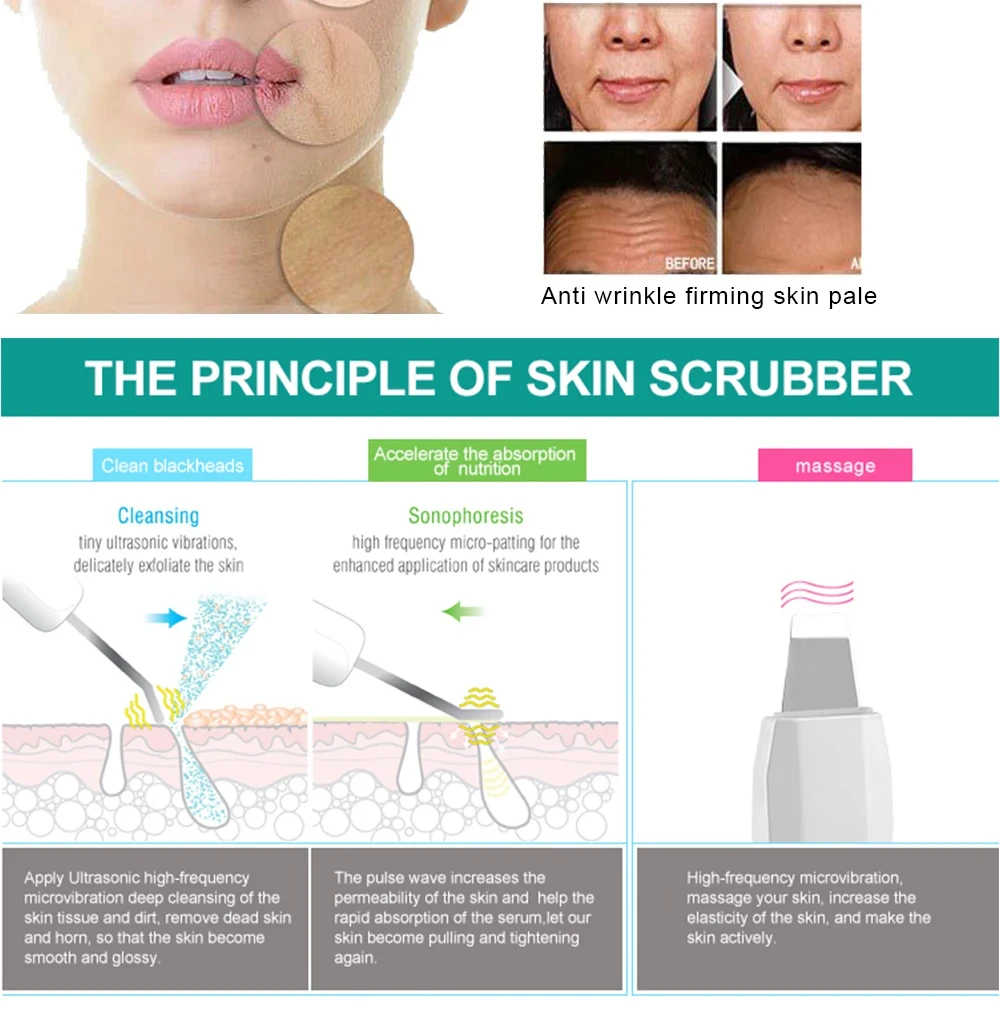 منظف بشرة الوجه بالموجات فوق الصوتية ، أيون ، حب الشباب ، مزيل الرؤوس السوداء ، مجرفة تقشير ، مدلك ، العناية بالبشرة ، قوية #6