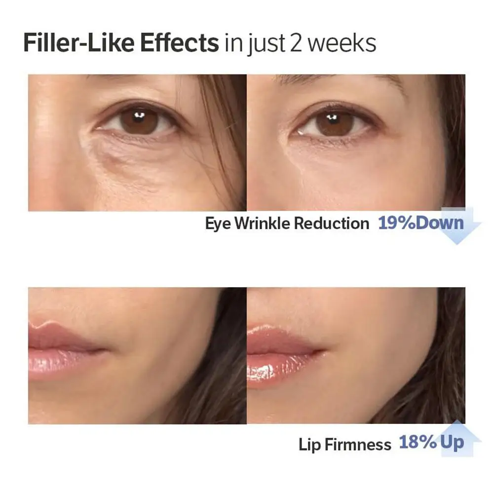 مصل تعزيز قوة الكولاجين العميق Sbedt المضاد للتجاعيد العلامة التجارية الأصلية العناية بالوجه تبييض ترطيب تنعيم الخطوط الدقيقة جوهر