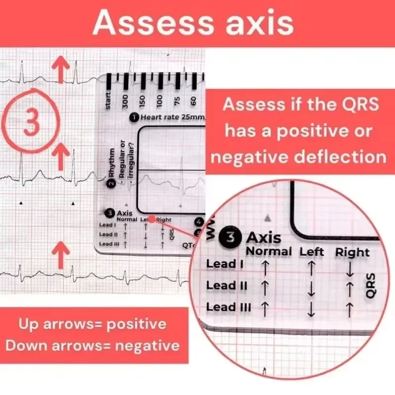 Ecg 7 Step Ruler 7 Step Scale for Ecg Observation Portable Transparent 7step Ruler Measurement Tool Ruler for Ecg Interpretation