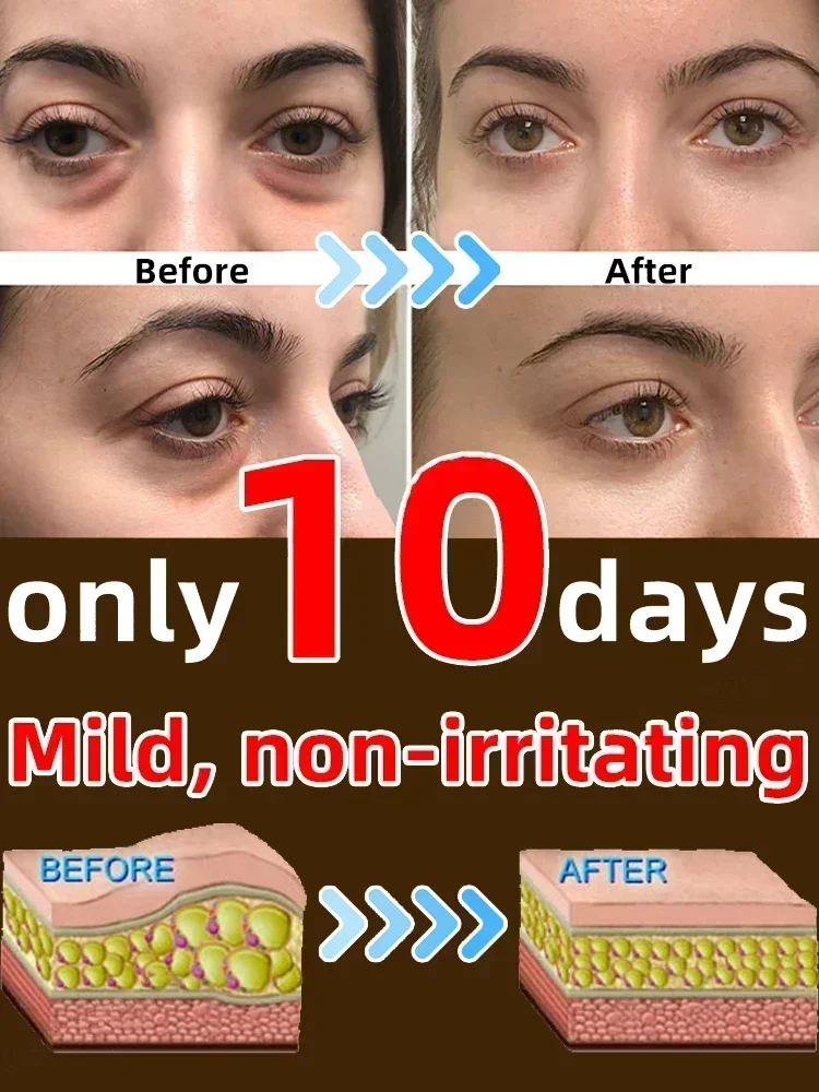 7 Days Magical Anti-Wrinkle Eye Cream Fade Fine Lines Anti Dark Circles Serum Remove Eye Bags Puffiness Anti-Aging Firm Eye Care