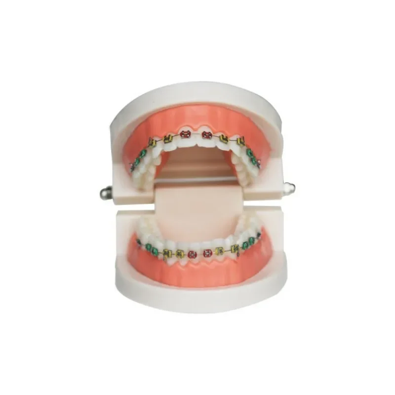 

Dental Orthodontic Tooth Model Cermet Contrasting Brackets Communication Dentist Demo Studying Tooth Crown Standard Implants