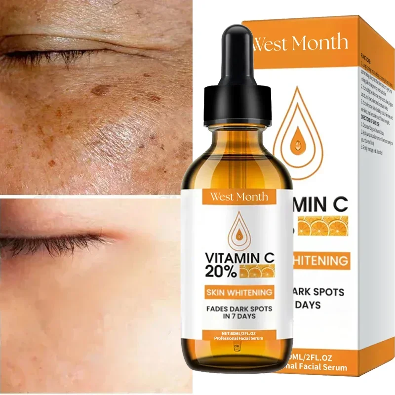 

Vitamin C Whitening Freckles Face Serum Fast Remove Dark Spots Fade Melanin Anti-Wrinkle Brightening Nourishing Firm Skin Care