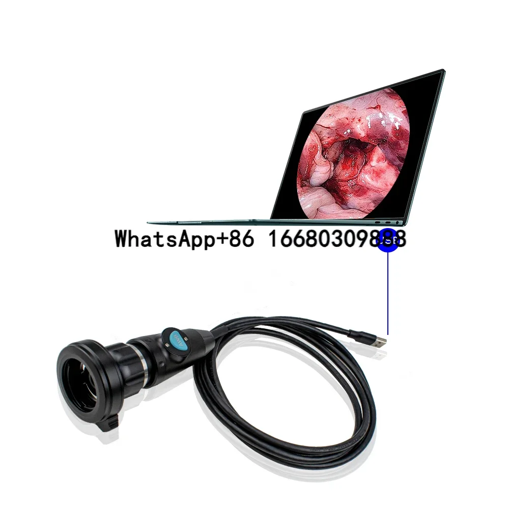 

TUYOU Portable USB Veterinary Clinic Equipment for Medical Animal Pet Endoscope