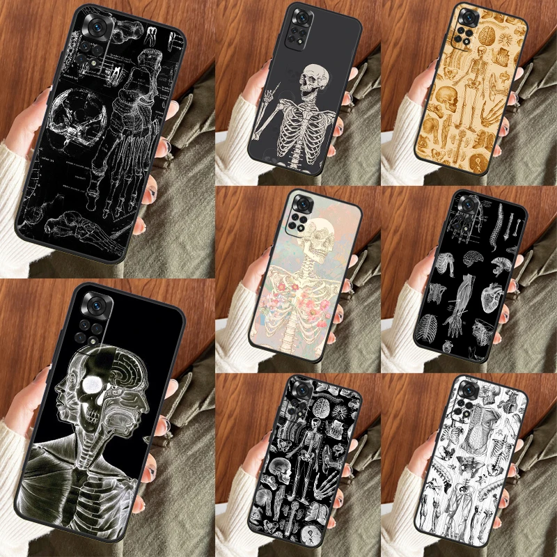 Medical Skeleton Anatomy Case For Xiaomi Redmi Note 12 Pro Redmi Note 11 8 9 10 Pro 9S 10S 11S 10C 9C 9A 12C Cover