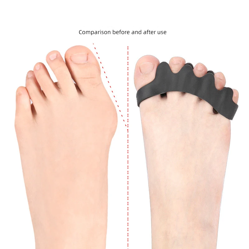 1Pair Toe Separator Hallux Valgus Corrector Finger Bunion Orthotics Protector Overlapping Forefoot Pad Foot Care Pedicure Adjust