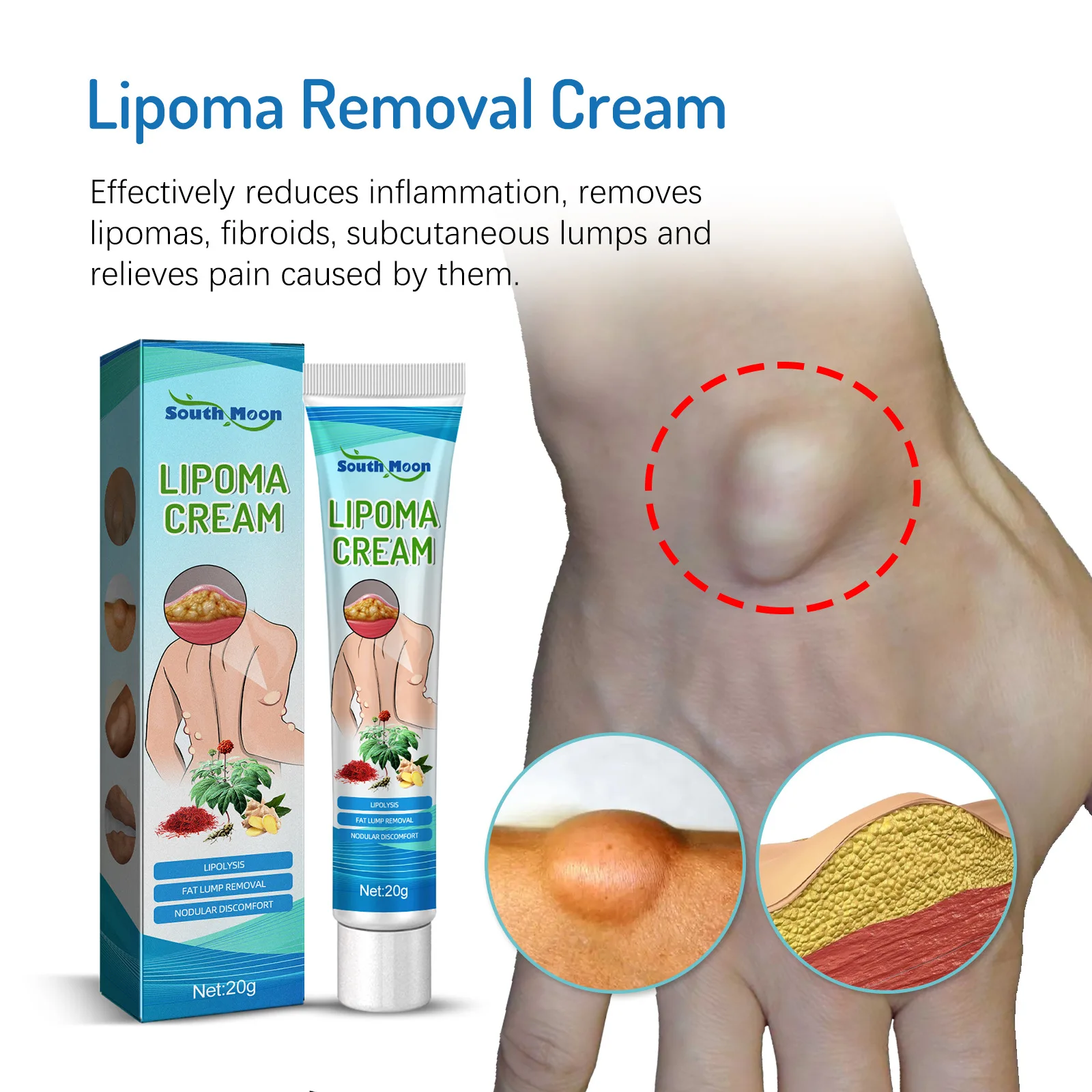 

Lipoma Removal Cream Lipolysis Fat Lump Relief Plaster Skin Swelling Fat Elimination Cream Free Shipping 20g Health Care