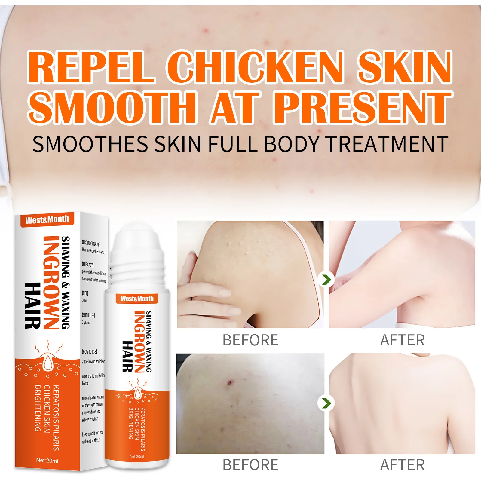 Ingrown Hairs Treatment Serum, Dark Spot Reduction