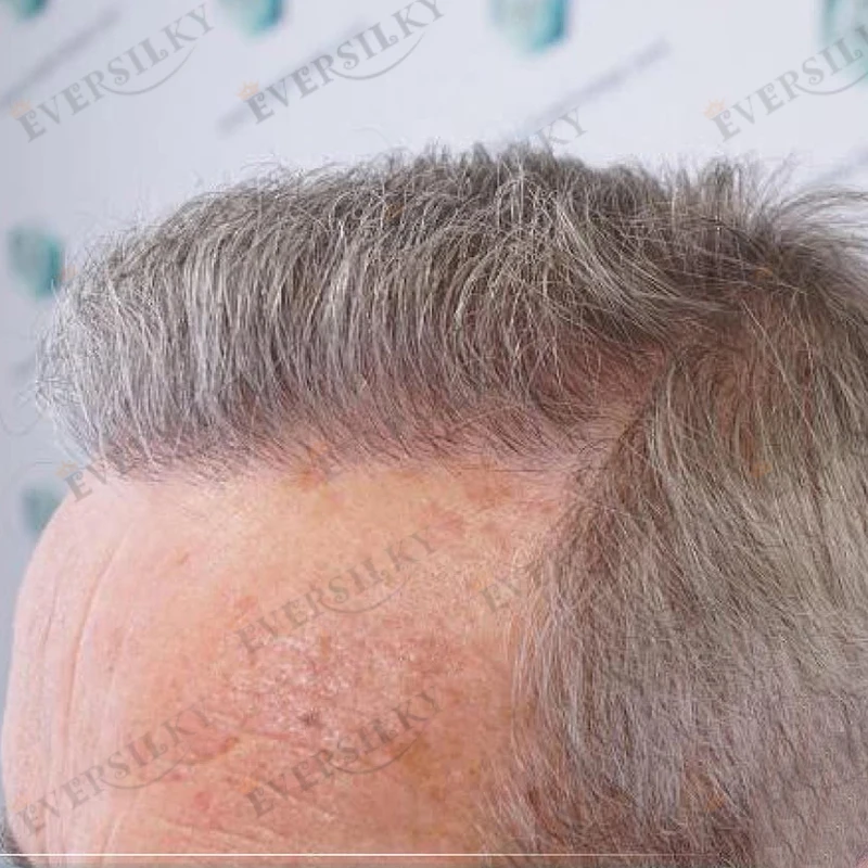 Mikrodünne Hautbasis-Männerperücken, unsichtbar, 0,02 mm, super natürlicher Haaransatz, Herren-Toupet, 100 % Echthaar, Kapillarprothesensystem – Detail 2