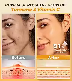 센텔라 수딩 리페어 세럼 크림