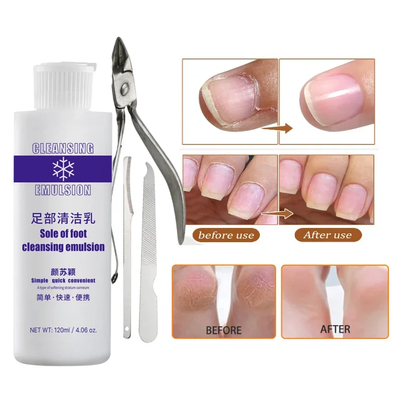 Adoucisseur exfoliant pour les pieds, 120ml et acier inoxydable, coupe-ongles, ensemble de ciseaux, élimine les callosités de la peau morte, Kit de pédicure, 4 pièces