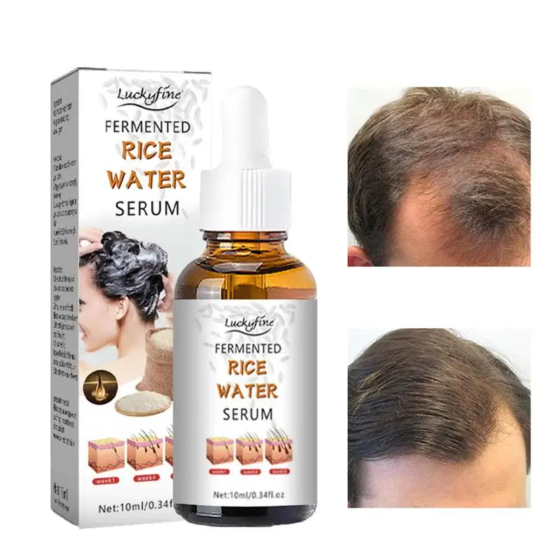 Fermented Rice Water For Hair Growth Essence Drops Thickening Hair Products To Strengthen Hair Fermented Rice Water Serum Oil