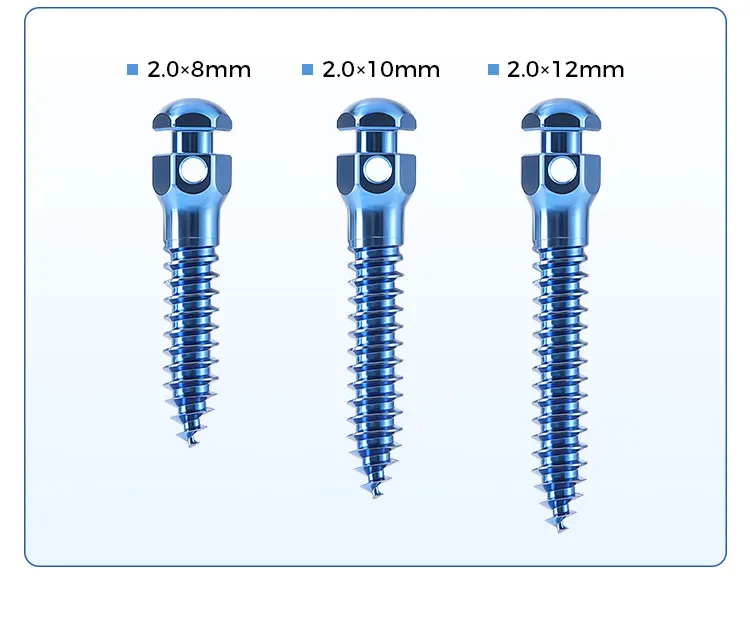AZDENT Dental Orthodontic Mini-Schraube Sterile Titanlegierung Selbstbohrende Gewindeschrauben Implantat-Mikroschrauben Zahnmedizin – Detail 8
