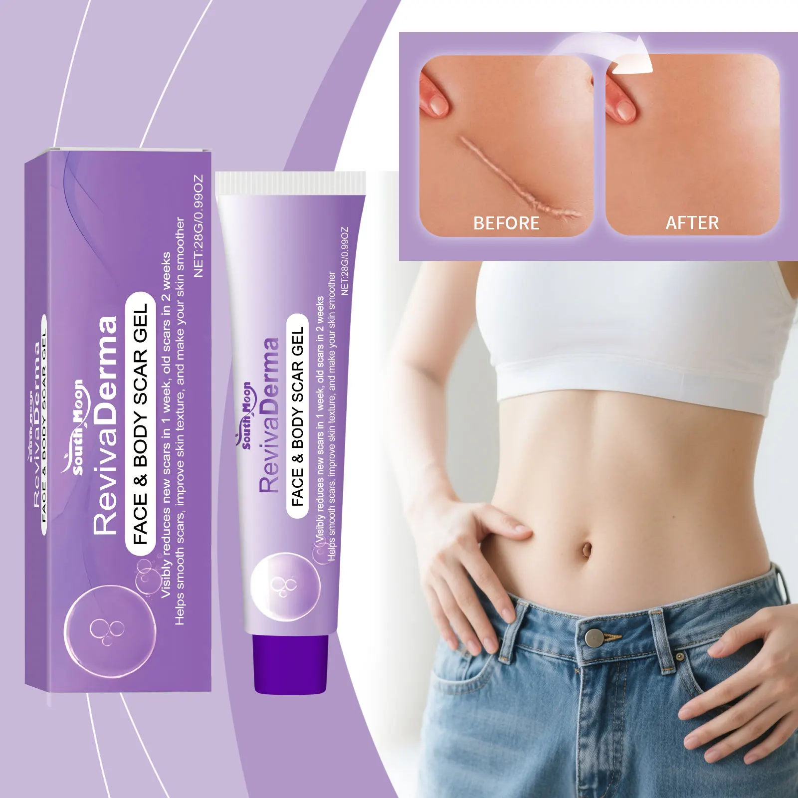 Erweichungs- und Glättungshaut, Narbenverblassendes Körperpflegegel, sanfte Pflege der Körperhaut, feuchtigkeitsspendendes, glättendes Hautpflegegel