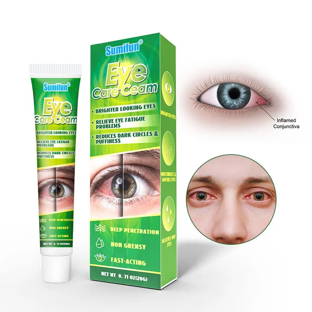 Crema china de medicina Herbal para el cuidado de los ojos, Ojos de aspecto más brillante, alivia los problemas de fatiga ocular, reduce las ojeras y la hinchazón