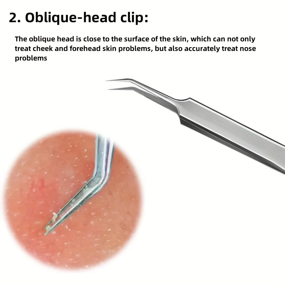 美容ツール 3 点セット、ニードル セット、ステンレス製の黒ずみ &amp; セット - 精密ピンセットとセル クリップ、無香料