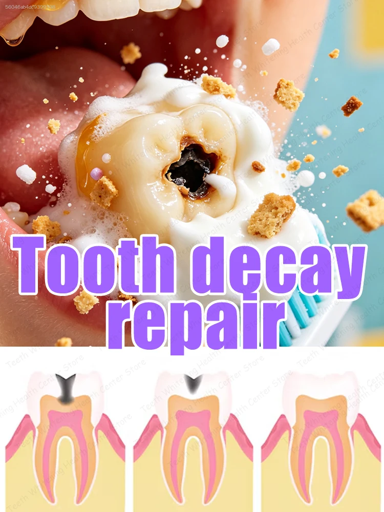 This toothpaste will be your best choice; it's easy to use and highly effective.