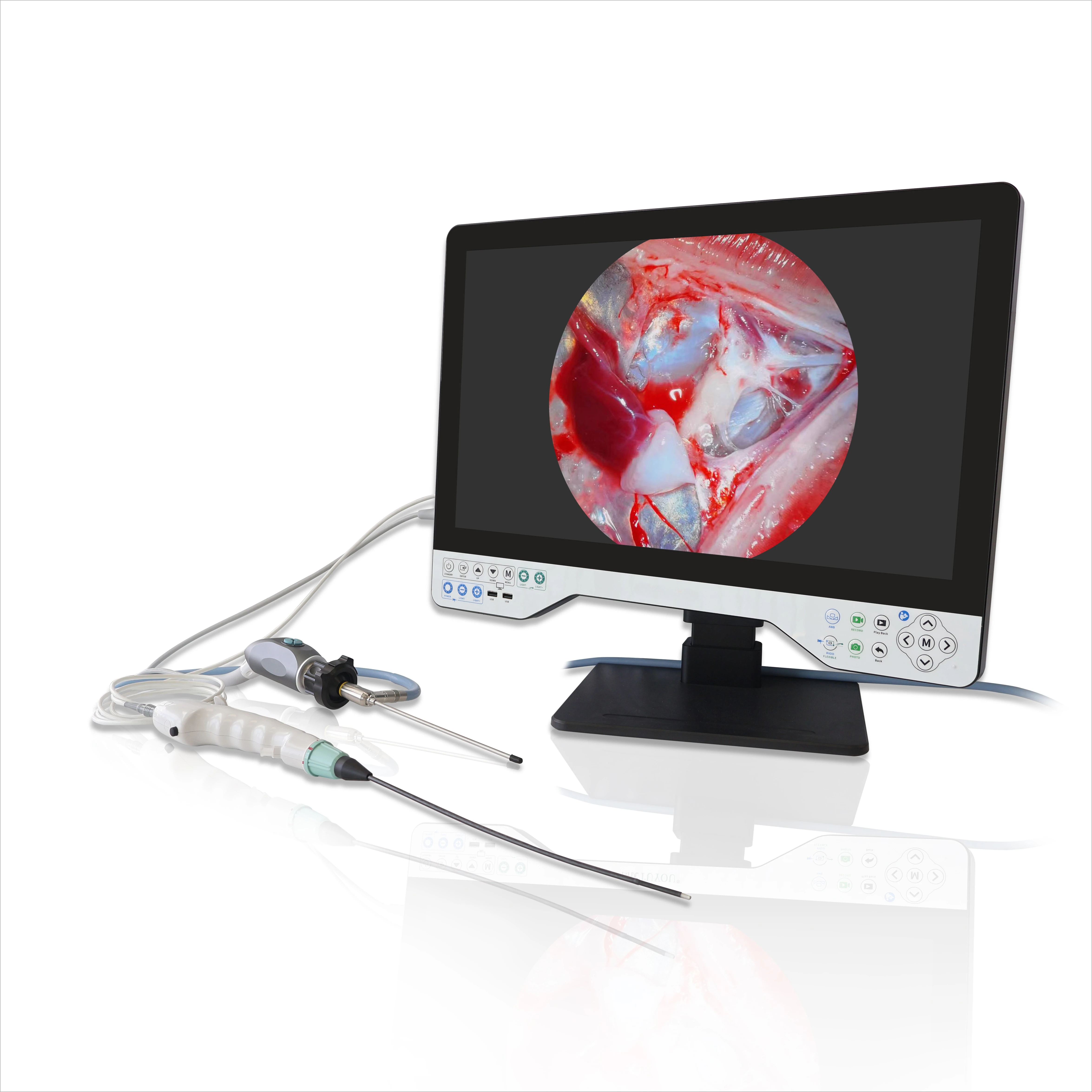 All in One Righid Multi Flexible Endoscopy Camera Full HD Light Source Endoscope Record System for Laparoscopy Uroscopy ENT