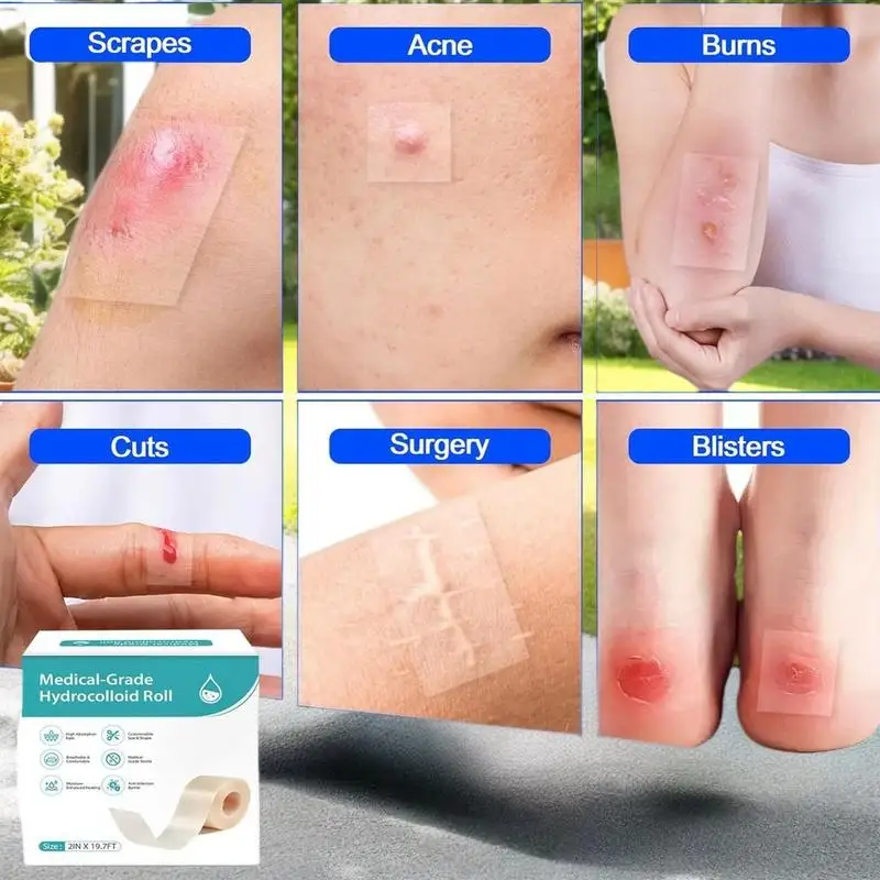 "Rolo de curativos hidrocolóides resistentes à água, band aid ultrafino e macio, autoadesivo para cuidados com feridas, fita para ocultar cicatrizes