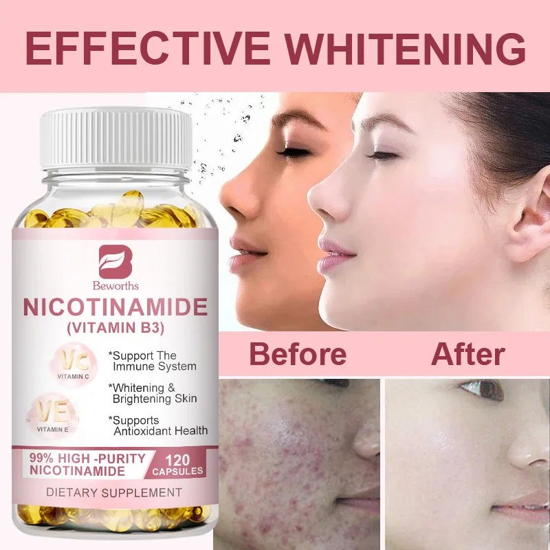 BEWORTHS Nicotinamide Whitening Capsule With Vitamin B3 Antioxidant Brightens Skin Tone Repairs Skin Baby Muscle Freckle Removal