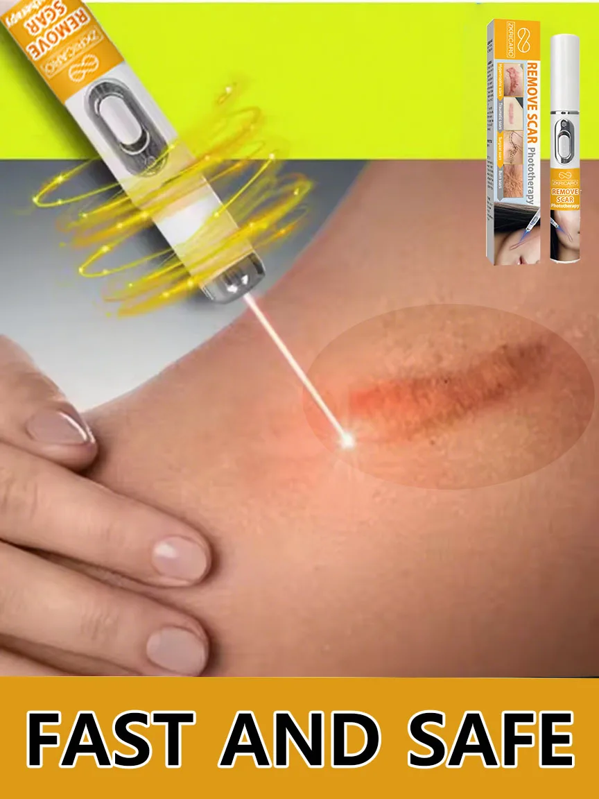 

Quick removal burn removalScar Recovery Soft whitening facial skin care