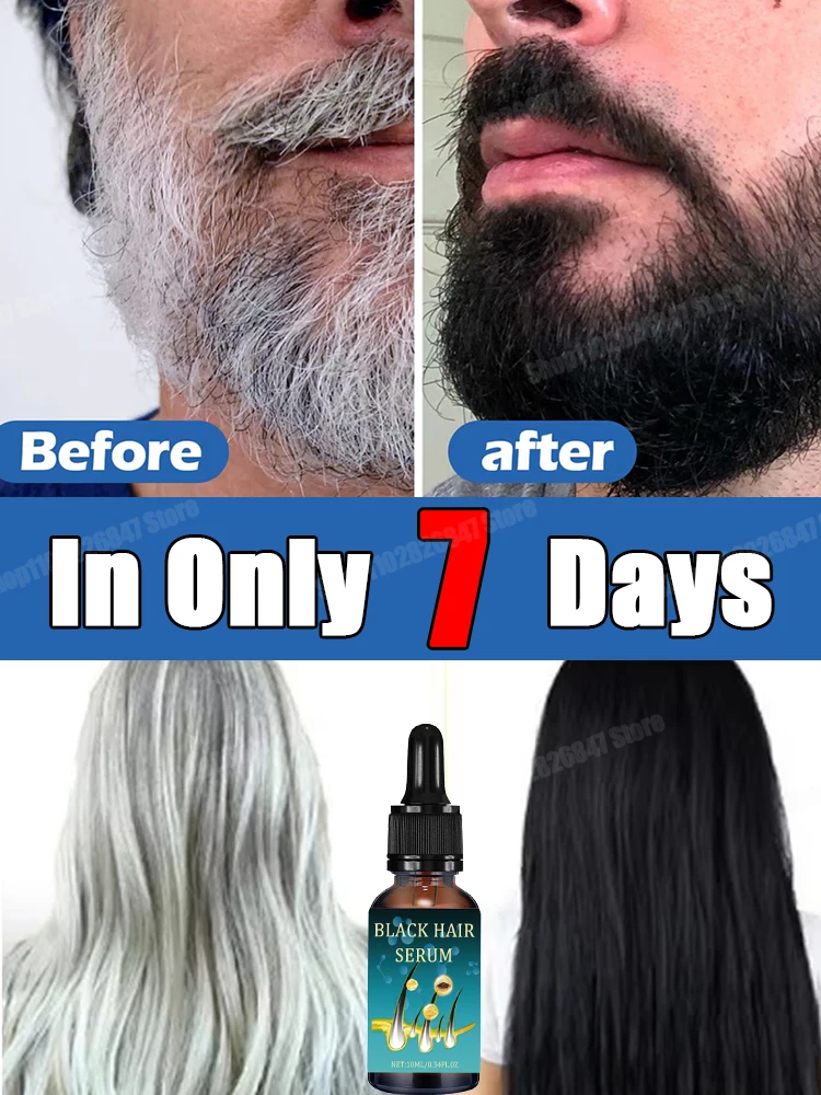 Gray White Hair Serum Liquid White To Black Natural Color Repair turns white into black, and prevents gray Men Women