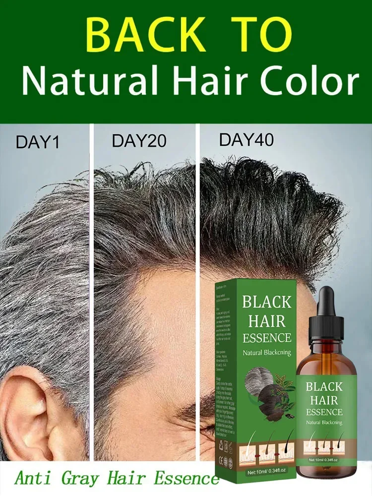 Gray White Hair Treatment Serum Liquid White To Black Natural Color Repair turns white into black prevents gray Men Women NEW