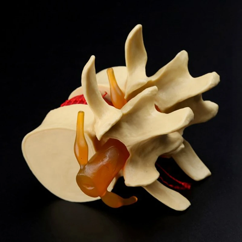 Lumbar Vertebrae Model Anatomical Spine Lumbar Disc Herniation Anatomy Teaching Tool Lumbar Vertebrae Model