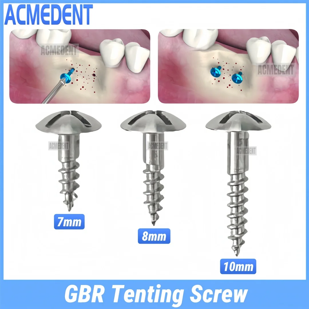 10pcs Dental Tent Screw GBR Bone Guide Bone Regeneration Membrane TAC Half Thread Tenting Screw 7/8/10mm