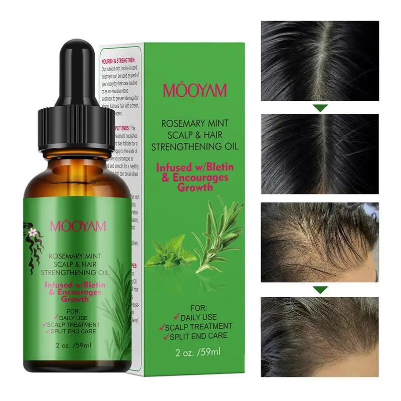 Hair Growth Oil Rosemary Oil Anti-frizz Anti Hair Loss Hairs Smooth Serum Hairs Care Hairs Loss Treatments New Fashion