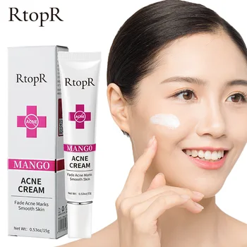 RtopR Mango Anti-acne Facial Cream เจลสิว Remover Remedy หดตัวรูขุมขนครีมบํารุงผิวสิว Face Care