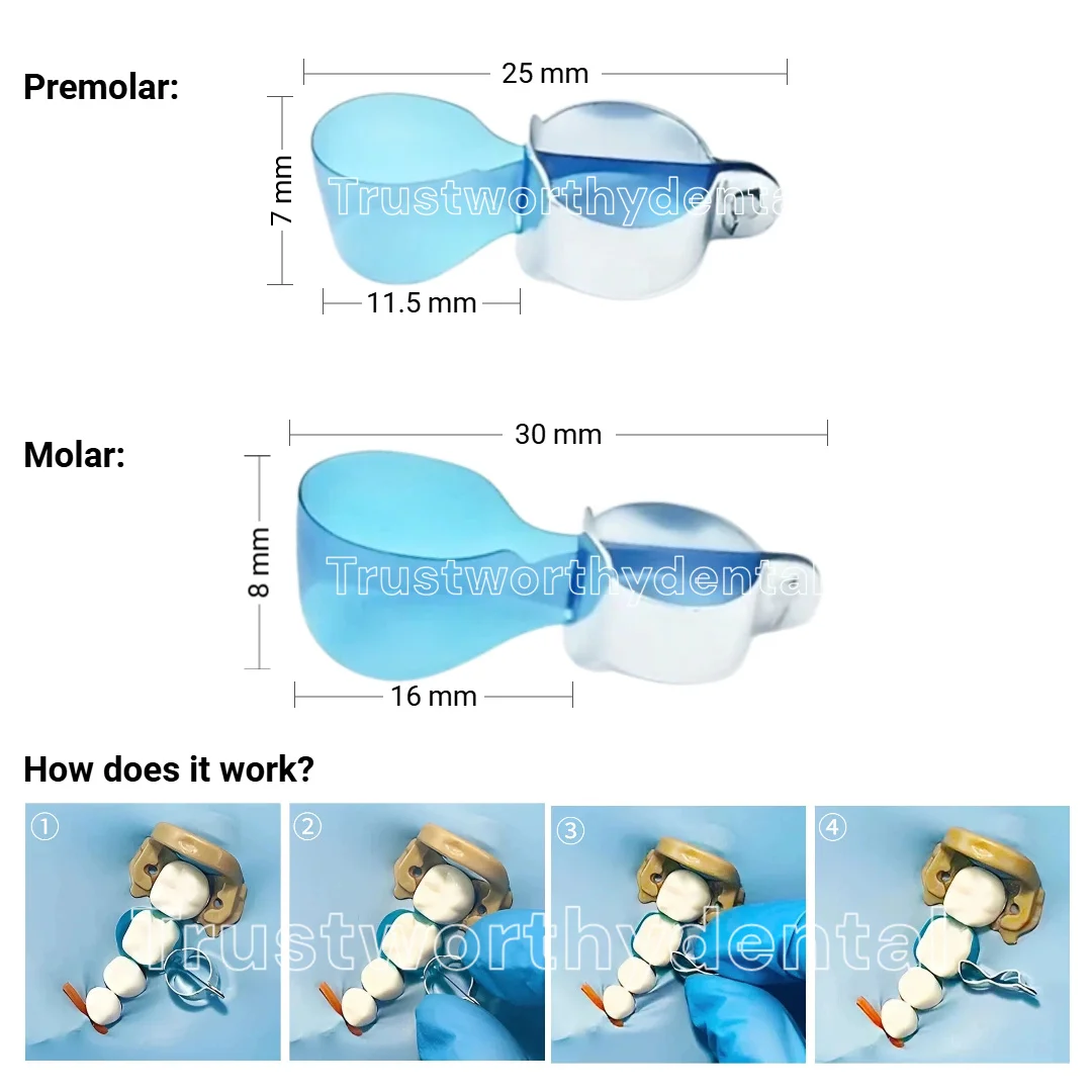 Dental Kerr Matrices Lucifix Type with Integrated Fixing Device Blue Matrix Bands Molar Premolar Class II Sectional Contoured