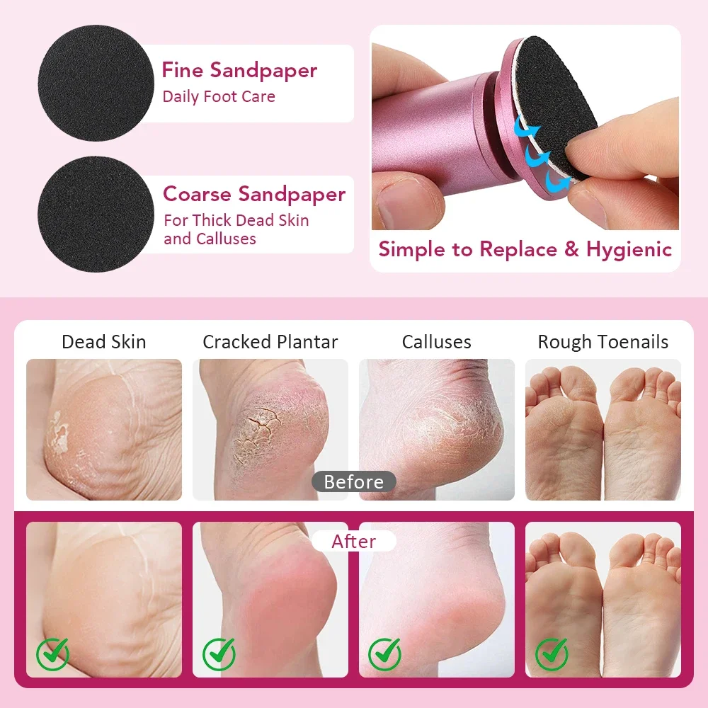 Thumbnail 4 - #46 Best Selling Foot Files