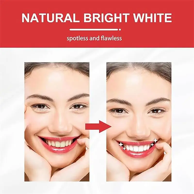 Aloe Toothpaste Removes Yellowing Stains Protect Gums Whiten Teeth Deeply Clean Tooth Fresh Breath Oral Hygiene Care Toothpaste