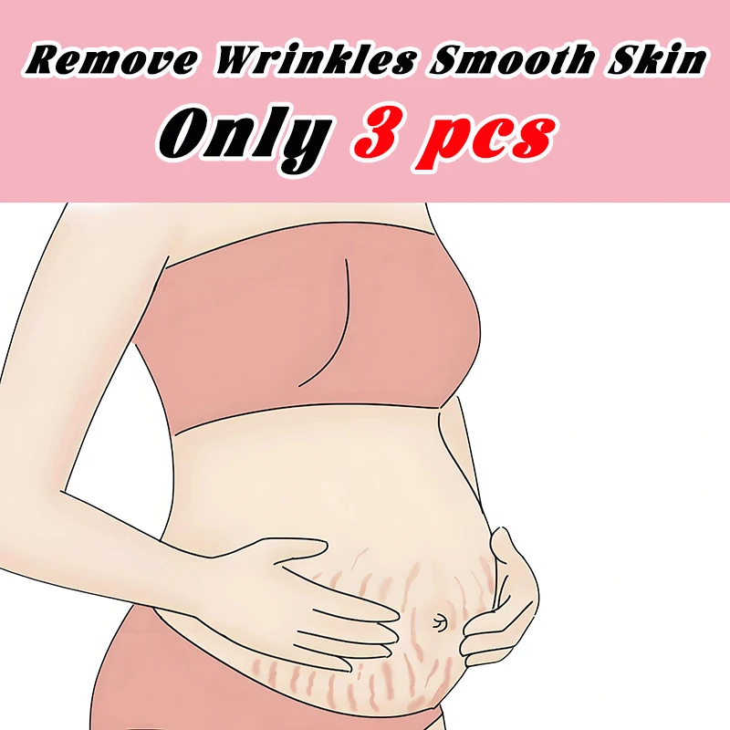 

Scar Removal Laser Pen Laser Treatment For Removing Stretch Marks Stretch Mark Obesity Mark Repair Tool