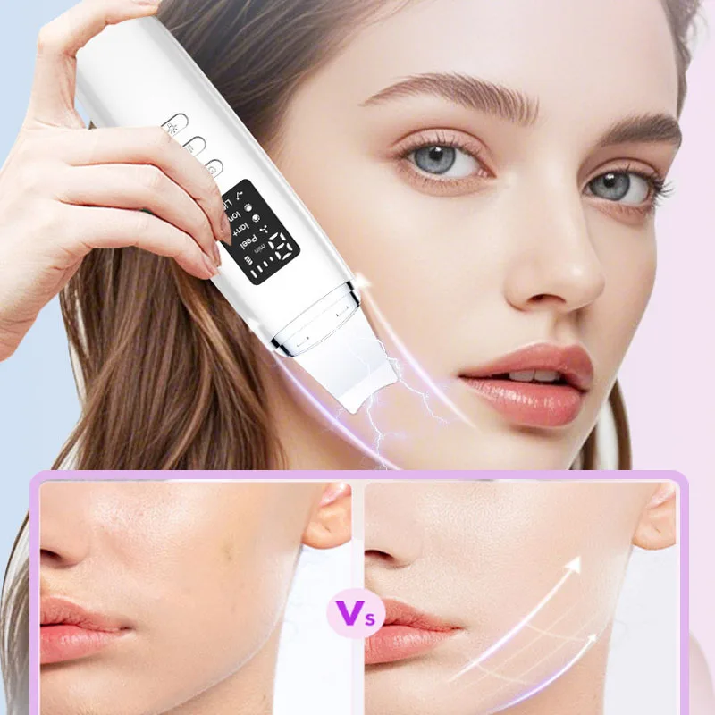 EMS بالموجات فوق الصوتية الجلد الغسيل الاهتزاز الوجه ملعقة مزيل الرؤوس السوداء مجرفة نظيفة التجويف تقشير الوجه رفع العناية بالبشرة #1