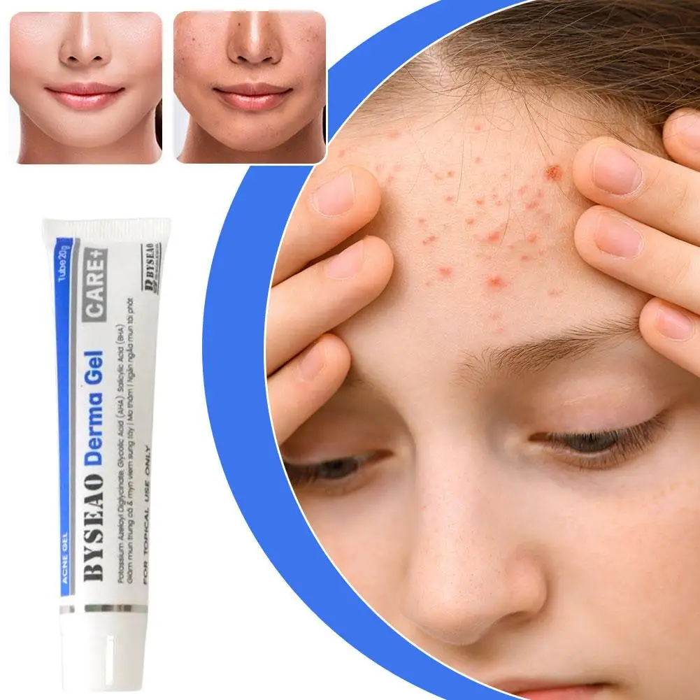 

Укрепляющий крем для лица с салициловой кислотой от акне: уменьшает отечность, подтягивает кожу, разглаживает мелкие морщины, увлажняет, устраняет следы от акне, глубоко очищает.