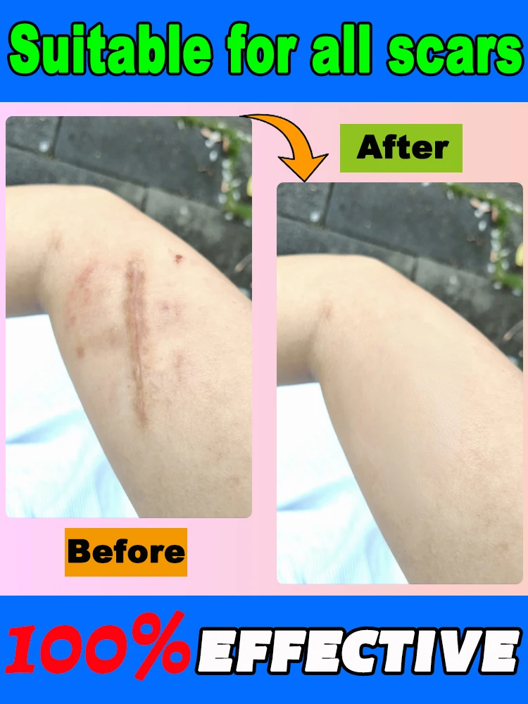 A pele diventa gradualmente mais suave e mais flexível