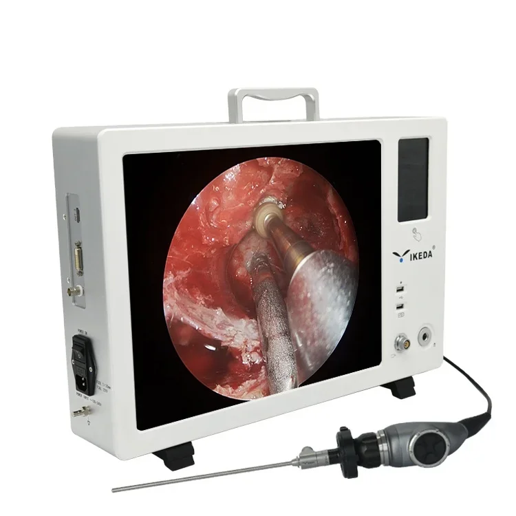 All in one medical hd endoscopy  for rigid optic endoscope