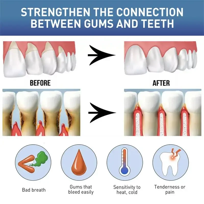 Gum Care Gel Relieves Swollen And Painful Gumscleans Plaquewhitens Teethreduces Dental Inflammation And Discomfort