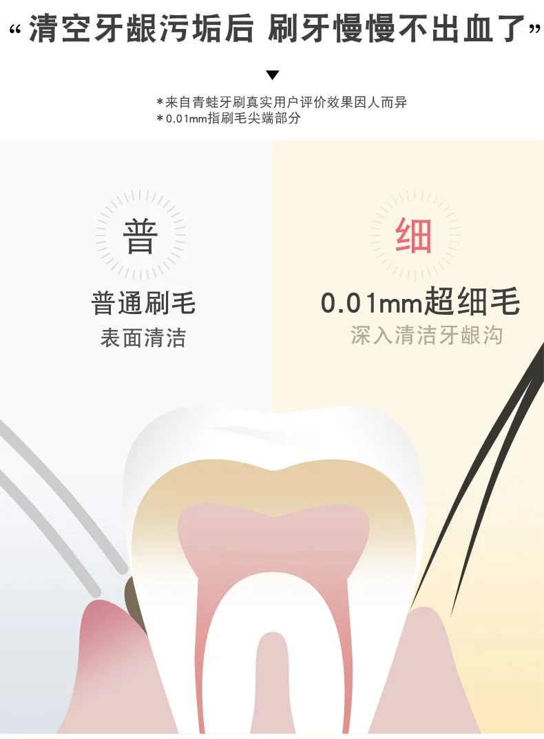 Gum protector for men and women, medium soft fur family wear, adult size, super slim and durable for adults